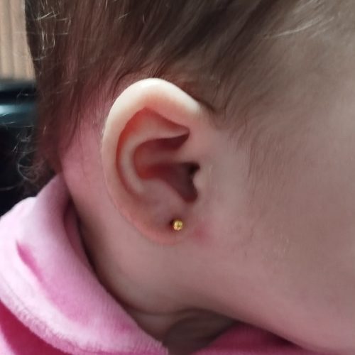Bebê com brinco de ouro após furo de orelha humanizado realizado na Clínica Mamma Gaia